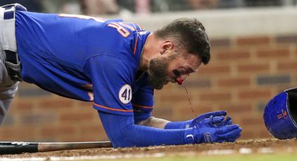 Kevin Pillar, de los Mets, recibe brutal pelotazo en la cara a 95 millas por hora