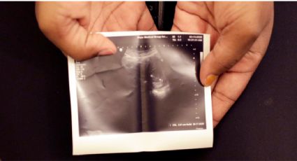 Médicos y activistas presentan demanda para frenar ley que restringe el aborto en Texas