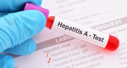 Hay 650 casos de hepatitis infantil aguda en todo el mundo, informa la OMS