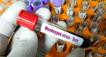 Regulador europeo analiza autorizar el uso de una vacuna contra la viruela para enfrentar la variante del mono