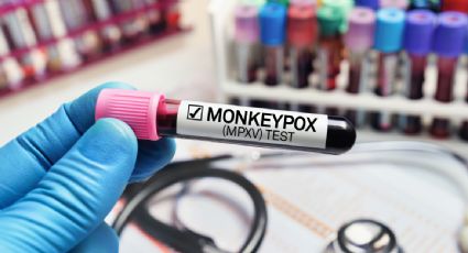 Nueva York activa un servicio de información telefónica sobre la viruela del mono por el incremento de casos