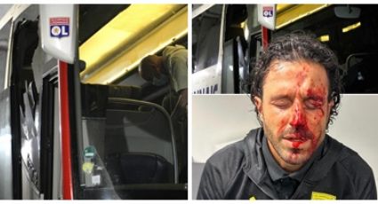 Suspenden en Francia el Marsella-Lyon tras agresiones al autobús visitante; el técnico Fabio Grosso resultó herido