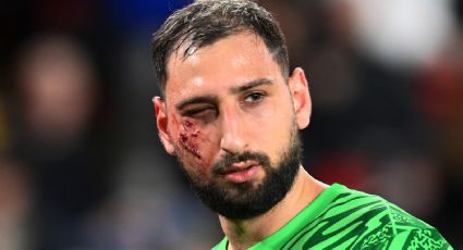 Gianluigi Donnarumma, portero del PSG, recibe una patada en el rostro y queda marcado con impactantes heridas