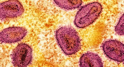 Pakistán es el primer país de Asia en registrar un caso confirmado de mpox del nuevo brote; hay dos más bajo sospecha