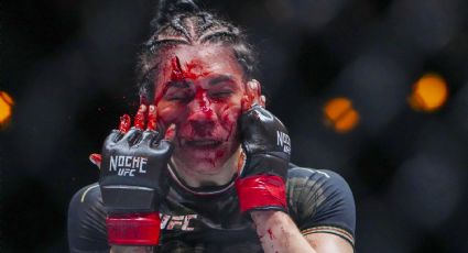 La mexicana Irene Aldana sufre impactante corte en la frente, uno de los más brutales en la historia de la UFC