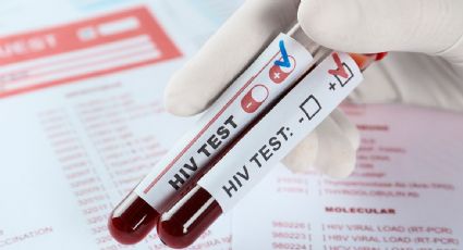 México identificó más de 15 mil casos nuevos de VIH durante 2025