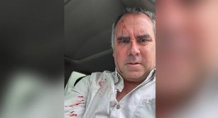 Atacan a tiros a candidato presidencial en Perú cuando viajaba en su automóvil; sobrevive con heridas leves