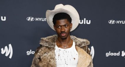 Lil Nas X es hospitalizado después de haber perdido el control del lado derecho de su cara