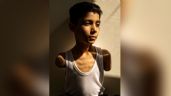 Foto ilustrativa de la nota titulada Retrato de niño amputado por un ataque israelí en Gaza, la imagen del año en el World Press Photo