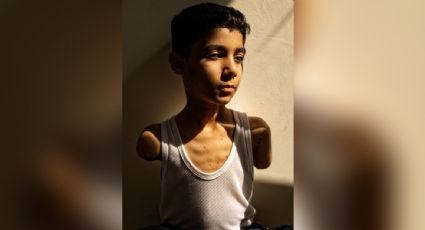 Retrato de niño amputado por un ataque israelí en Gaza, la imagen del año en el World Press Photo