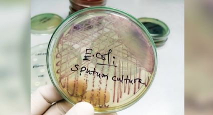 Se elevan a 25 los casos registrados por una intoxicación alimentaria en el norte de Francia