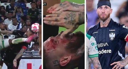 ¡De milagro no lo noquearon! Sergio Ramos, capitán de Rayados, recibe terrible patada en la cara y termina ensangrentado