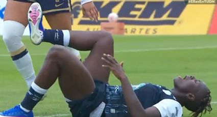Dramático momento: Chinwendu Ihezuo, delantera de las Tuzas, sufre aparatosa fractura de tobillo ante Pumas