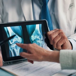Ozempic y sus similares aumentan el riesgo de padecer osteoporosis: Universidad de Pennsylvania