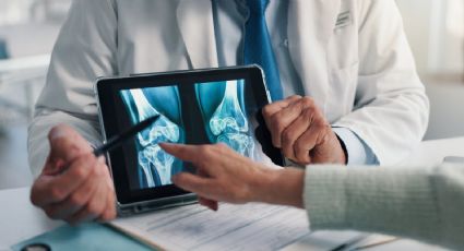 Ozempic y sus similares aumentan el riesgo de padecer osteoporosis: Universidad de Pennsylvania