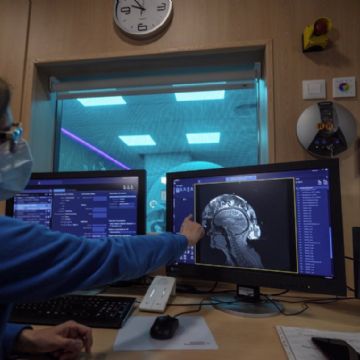 El rápido crecimiento del mal de Parkinson en México afectará en forma distinta a hombres y mujeres