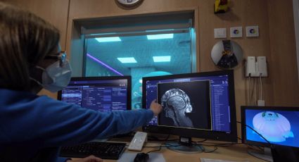 El rápido crecimiento del mal de Parkinson en México afectará en forma distinta a hombres y mujeres