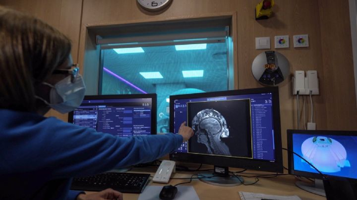 El rápido crecimiento del mal de Parkinson en México afectará en forma distinta a hombres y mujeres