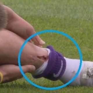 Futbolista sufre escalofriante corte en en la Eredivisie y abre debate sobre el uso de espinilleras