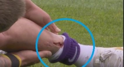 Futbolista sufre escalofriante corte en la pierna en la Eredivisie y abre el debate sobre el uso de las espinilleras cortas