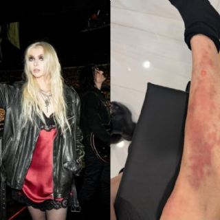 La cantante Taylor Momsen es hospitalizada en México tras picadura de araña venenosa