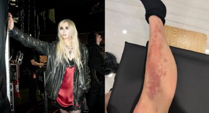 La cantante Taylor Momsen es hospitalizada en México tras picadura de araña venenosa