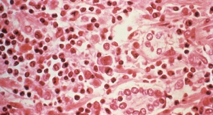 Chile reporta variante endémica del hantavirus: suma 13 muertos y 39 casos en lo que va del año