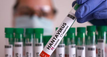 Expertos alertan fallas sanitarias de autoridades de EU por manejo del brote de hantavirus